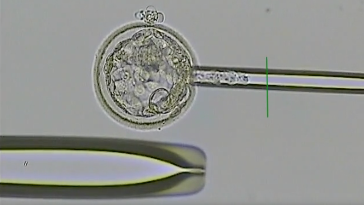 Does the embryo grade tell us everything we need to know?