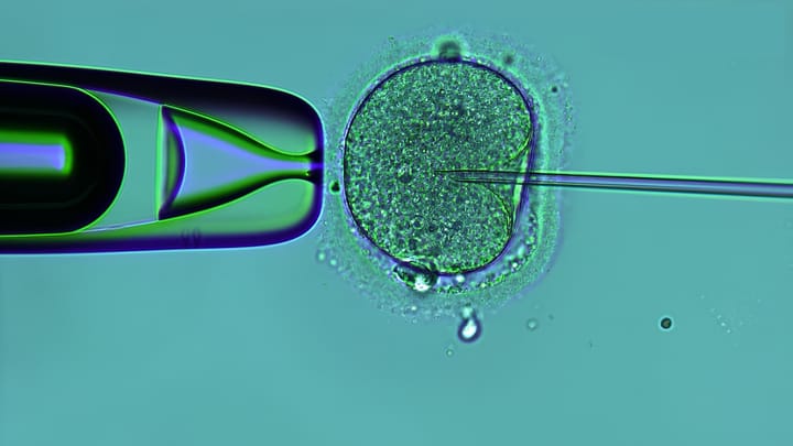 A microscopic image of a human egg being injected with a sperm, known as ICSI.