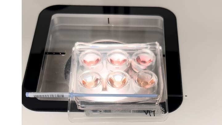 A dish prepared for freezing embryos, known as vitrification.