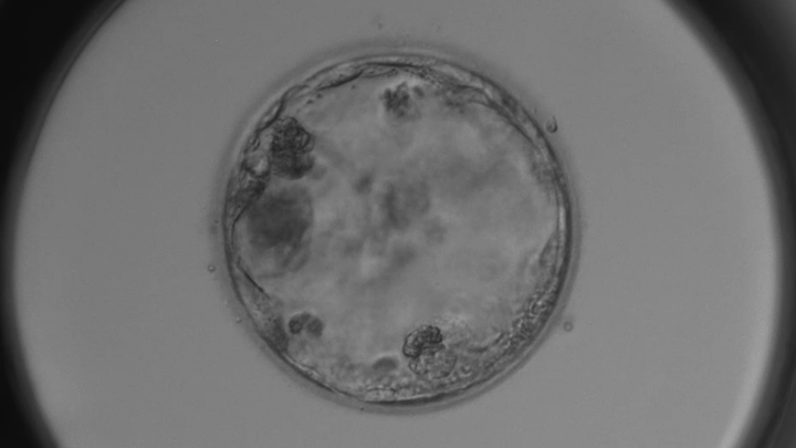 A 4CC graded embryo